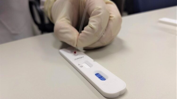 Distribuição de novo lote de testes rápidos para coronavírus a municípios começa hoje