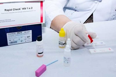 Testes rápidos de HIV, sífilis e hepatites B e C estão disponíveis na rede municipal de saúde (Foto: Divulgação)