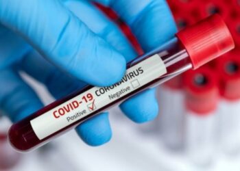 Cruzeiro do Sul registra 64 novos casos de Covid no fim de semana