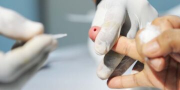 Unidades de saúde oferecem testes de hepatite