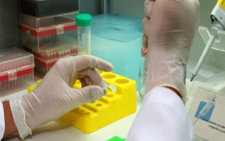 Testes rápidos para dengue e chikungunya são incluídos na tabela do SUS