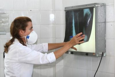 Levantamento destaca a necessidade de os governos aumentarem os esforços de combate à tuberculose que, em 2015, matou 1,8 milhão de pessoas no mundo (Foto: Agecom Bahia)